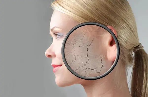 Comment savoir si ma peau est sèche - NICETYfem
