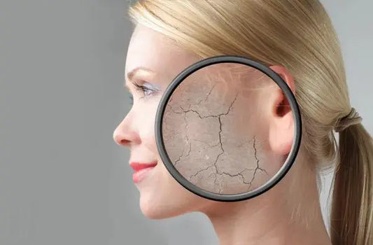 Comment savoir si ma peau est sèche - NICETYfem